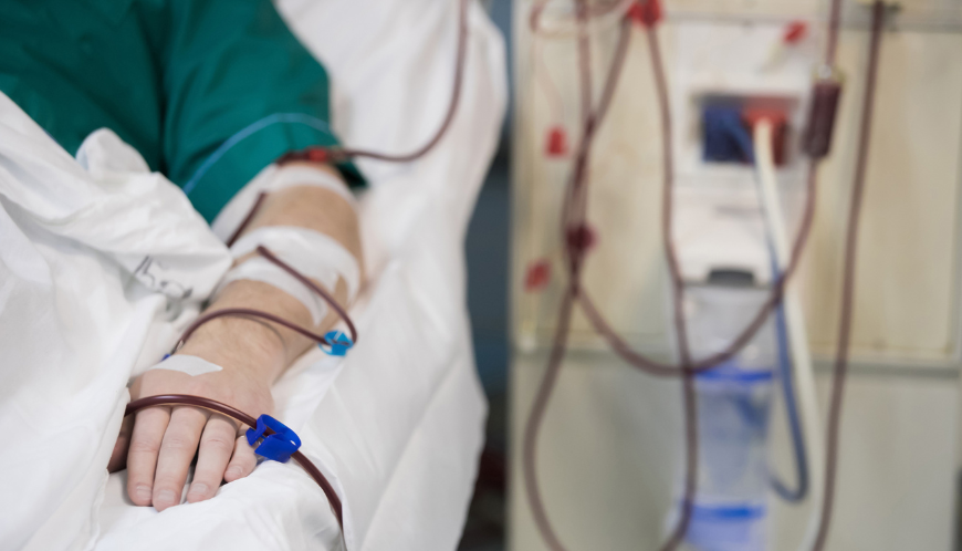 Dialysis Treatment